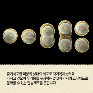 직접 줄기세포를 만들고 싶다는 꿈에 도전하다2에 관한 인포그래픽입니다. 자세한 사항은 하단에 있습니다.