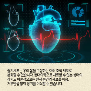 직접 줄기세포를 만들고 싶다는 꿈에 도전하다4에 관한 인포그래픽입니다. 자세한 사항은 하단에 있습니다.