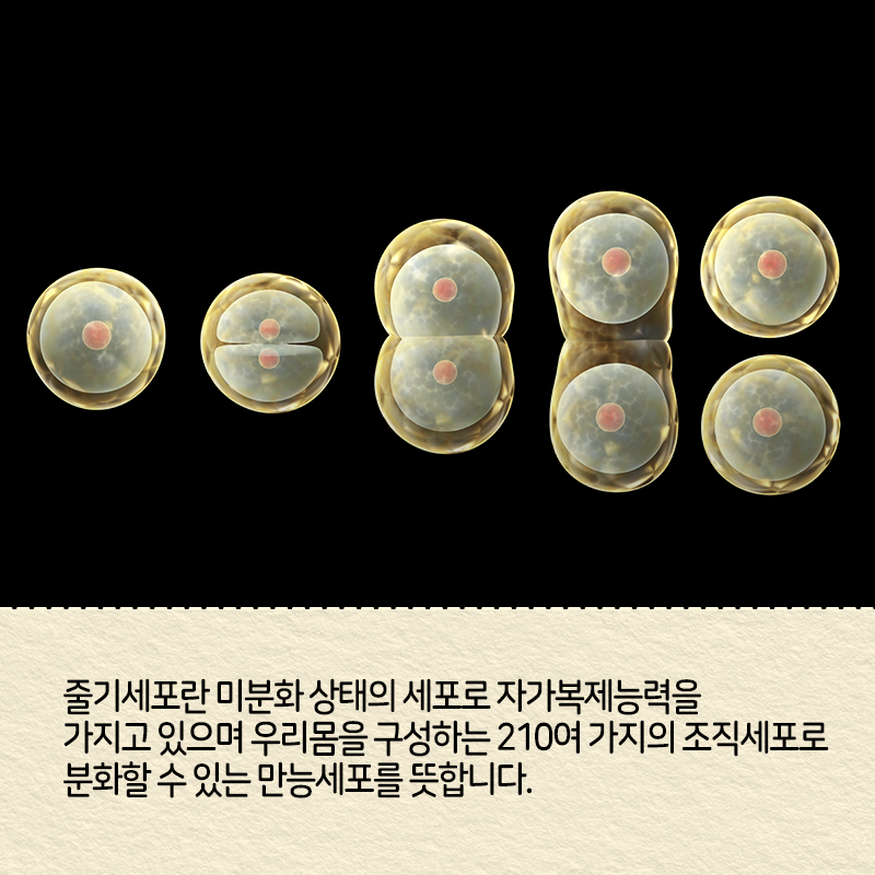 직접 줄기세포를 만들고 싶다는 꿈에 도전하다2에 관한 인포그래픽입니다. 자세한 사항은 하단에 있습니다.
