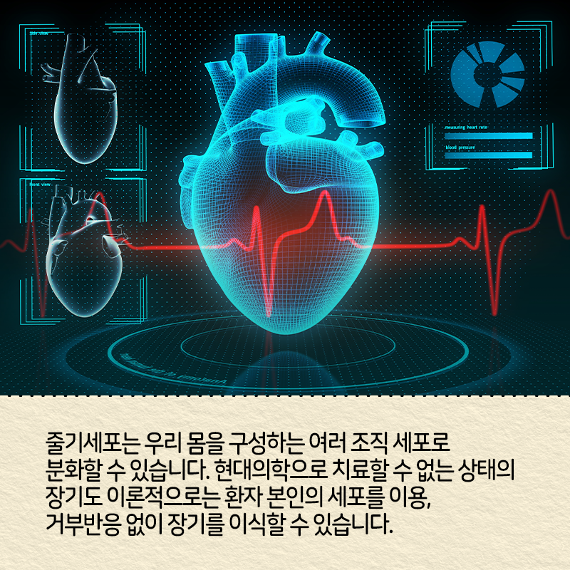 직접 줄기세포를 만들고 싶다는 꿈에 도전하다4에 관한 인포그래픽입니다. 자세한 사항은 하단에 있습니다.